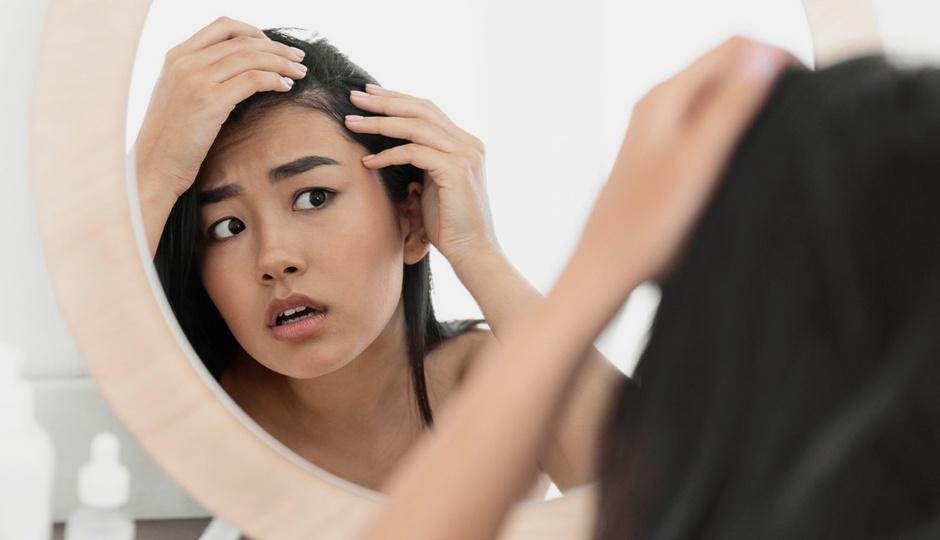 5 Hair Loss Myths