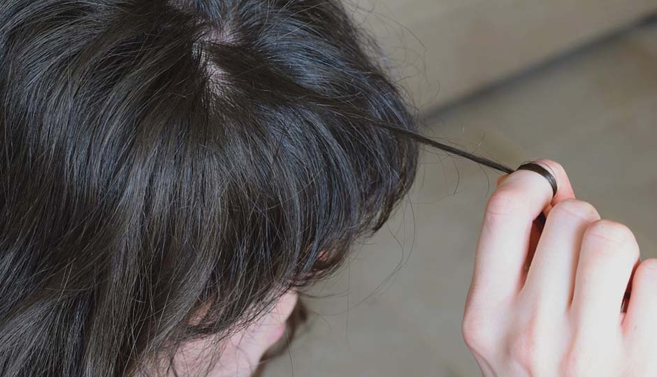 What Is Trichotillomania?