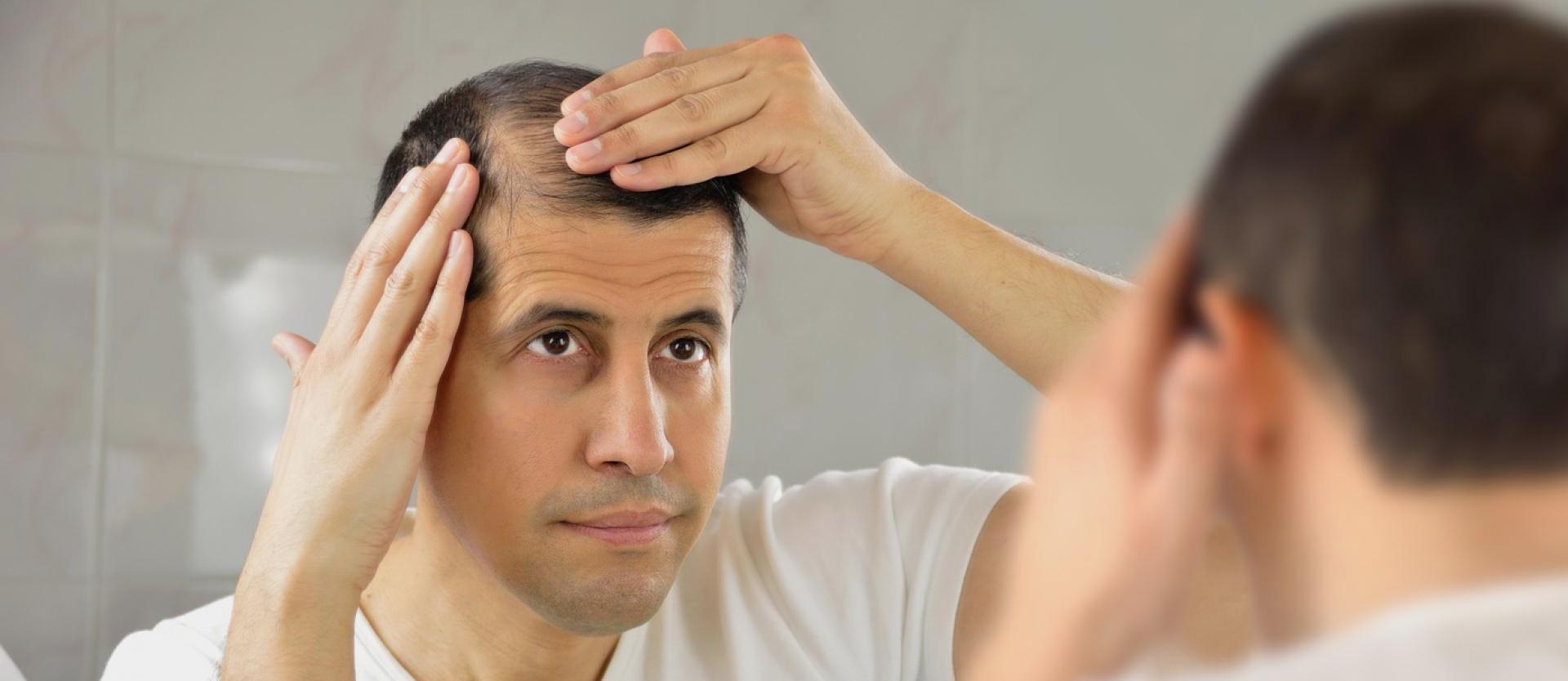Can Applying Oil to Your Scalp Lead to Hair Loss?