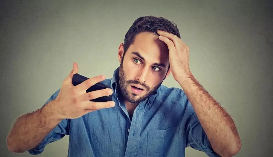 man suffering from male pattern baldness