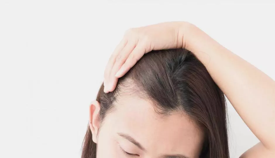 5 Unlikely Triggers That May Be Causing Your Hair Loss