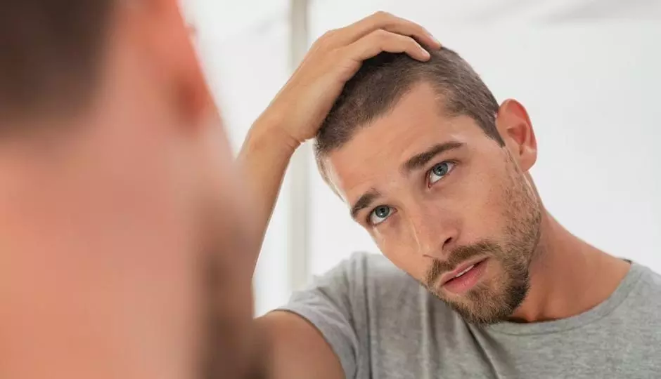 How Genetics Influence Hair Loss