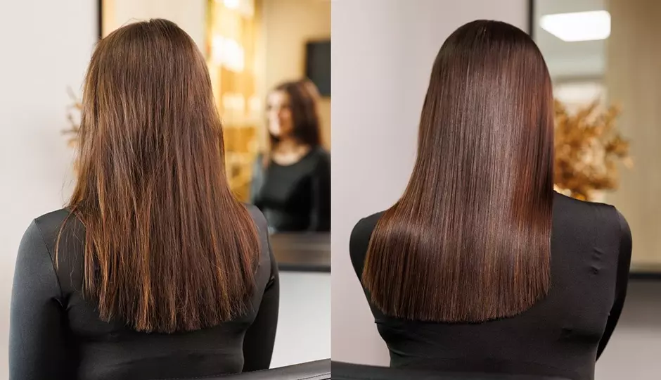 Do You Have Hair Loss or Thinning Hair and Thinking About Hair Botox?