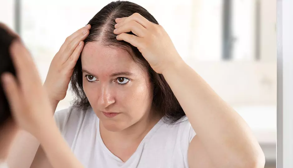 Triggers of Female Hair Loss
