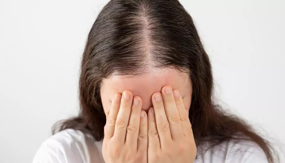 What Is Cicatricial (Scarring) Hair Loss?