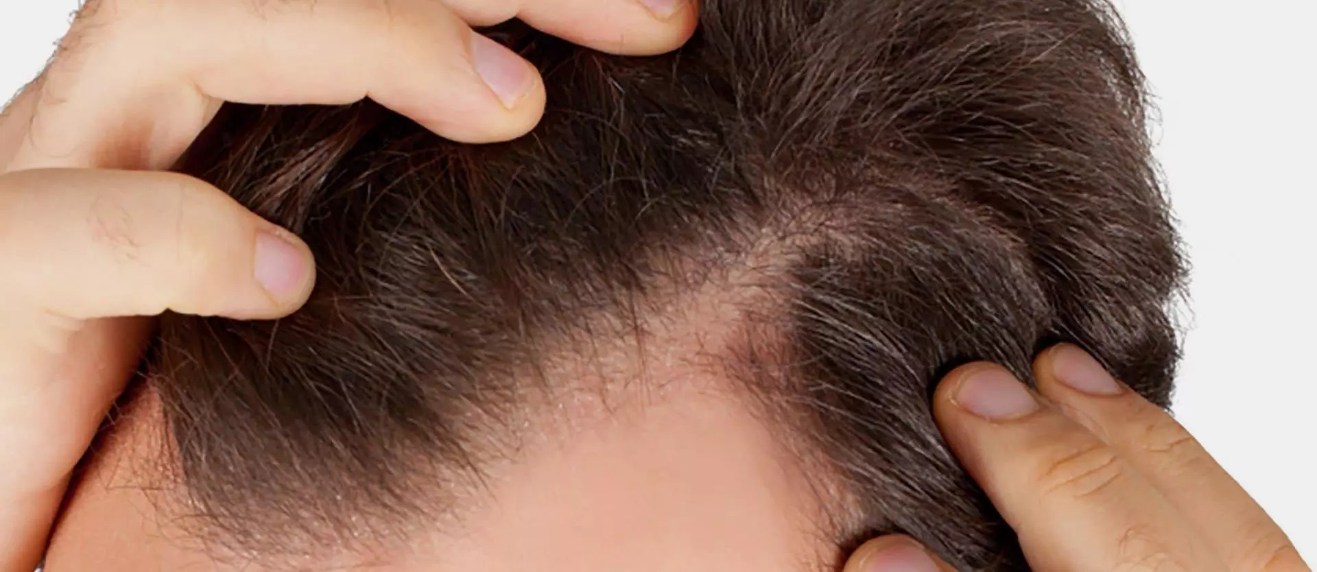 7 Hair Loss Culprits