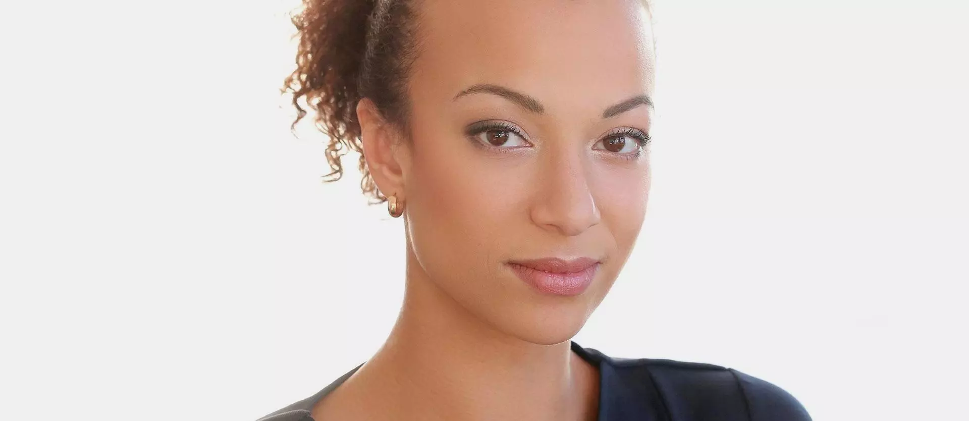 African American woman with traction alopecia