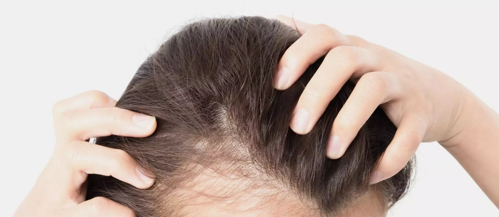5 Reasons Women Experience Hair Loss
