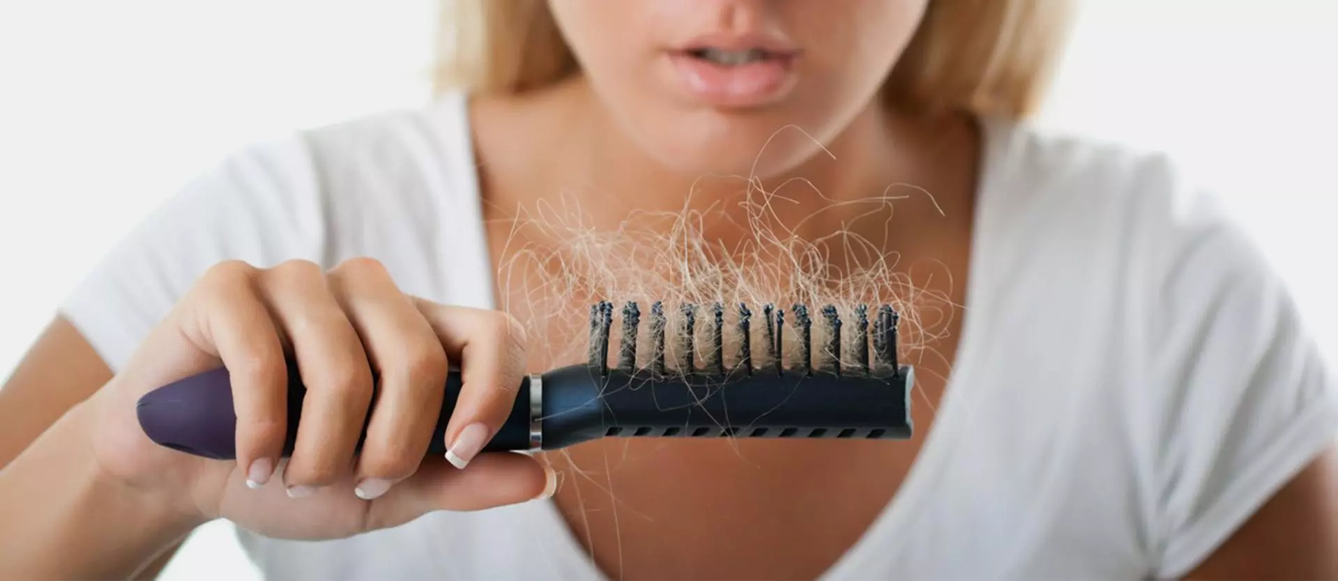 5 Triggers of Female Hair Loss