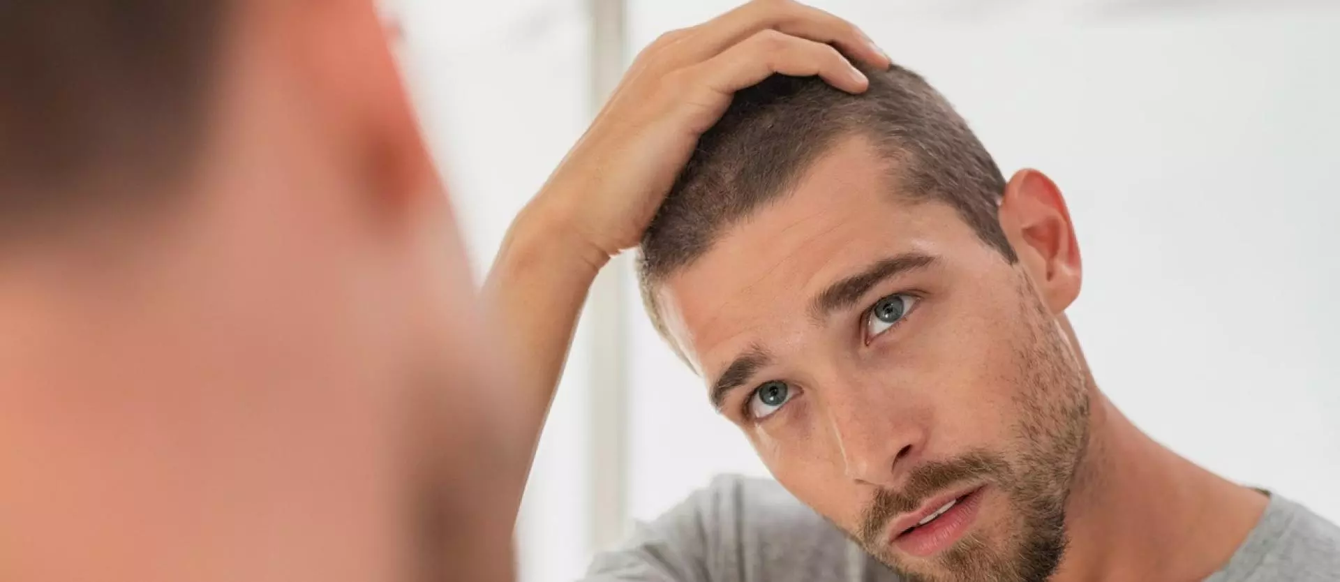 How Genetics Influence Hair Loss