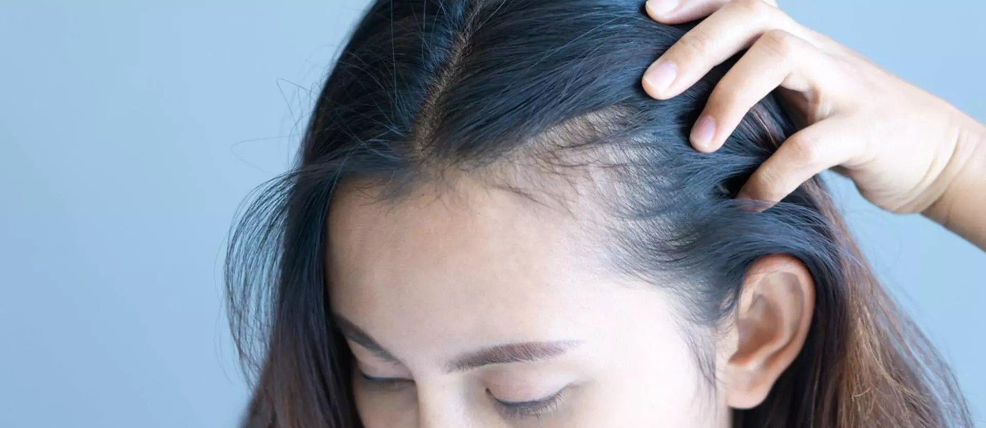 5 Facts Regarding Female Hair Loss