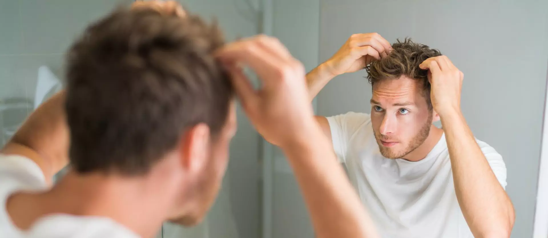 Male Pattern Hair Loss May Be Linked to Five Gene Variants
