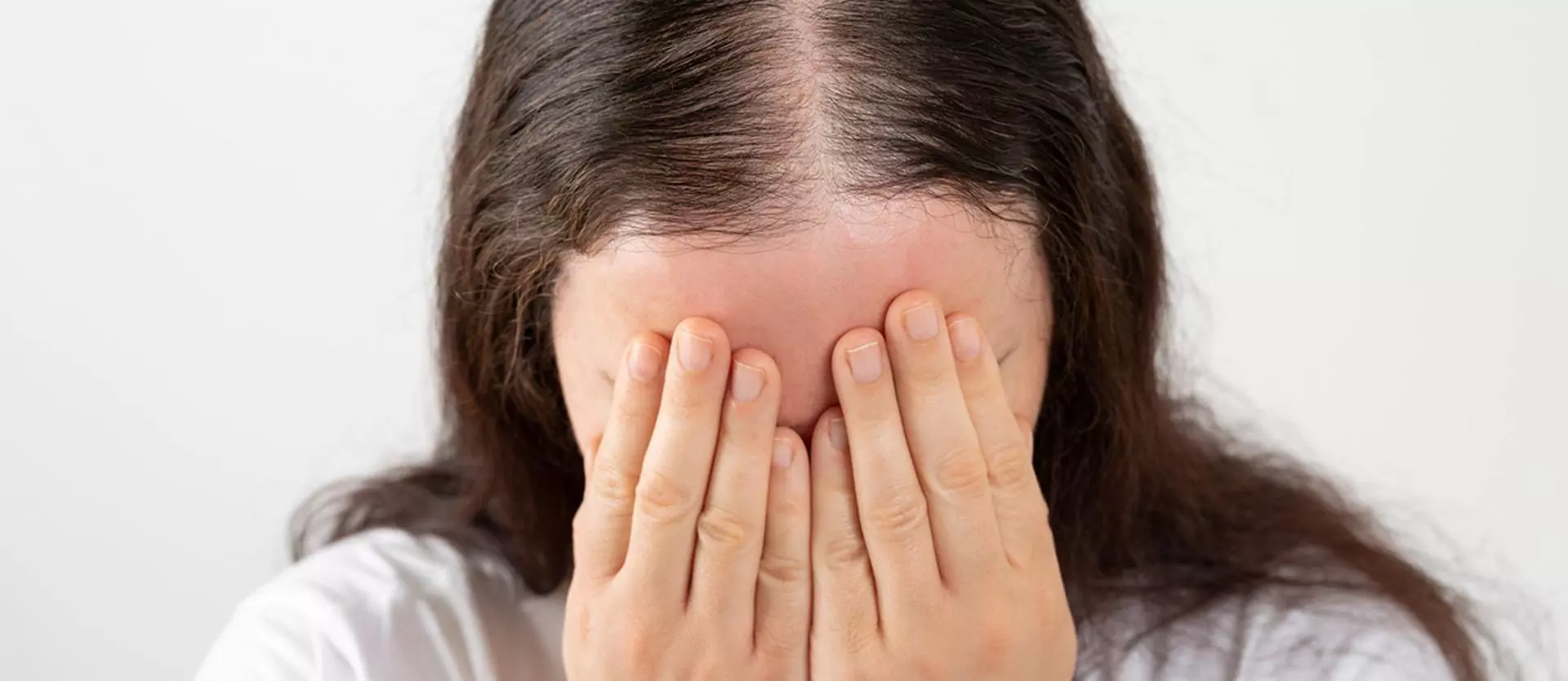 What Is Cicatricial (Scarring) Hair Loss?